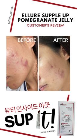 🇰🇷𝐌𝐀𝐃𝐄 𝐈𝐍 𝐊𝐎𝐑𝐄𝐀!🇰🇷 𝐄𝐋𝐋𝐔𝐑𝐄 𝟭𝟬-𝗜𝗡-𝟭 𝗥𝗘𝗗 𝗚𝗜𝗡𝗦𝗘𝗡𝗚 𝗦𝗞𝗜𝗡 𝗕𝗢𝗢𝗦𝗧𝗘𝗥 𝗝𝗘𝗟𝗟𝗬 | 𝐒𝐔𝐏-𝐈𝐓 𝐅𝐑𝐎𝐌 𝐊𝐎𝐑𝐄𝐀! SKIN SUPPLEMENT