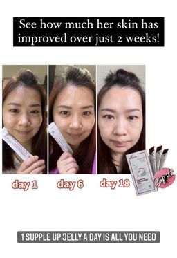 🇰🇷𝐌𝐀𝐃𝐄 𝐈𝐍 𝐊𝐎𝐑𝐄𝐀!🇰🇷 𝐄𝐋𝐋𝐔𝐑𝐄 𝟭𝟬-𝗜𝗡-𝟭 𝗥𝗘𝗗 𝗚𝗜𝗡𝗦𝗘𝗡𝗚 𝗦𝗞𝗜𝗡 𝗕𝗢𝗢𝗦𝗧𝗘𝗥 𝗝𝗘𝗟𝗟𝗬 | 𝐒𝐔𝐏-𝐈𝐓 𝐅𝐑𝐎𝐌 𝐊𝐎𝐑𝐄𝐀! SKIN SUPPLEMENT