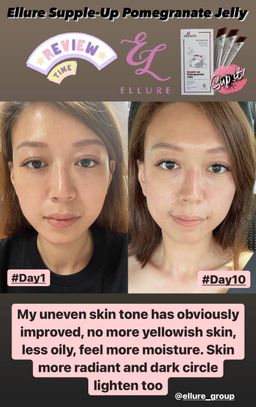 🇰🇷𝐌𝐀𝐃𝐄 𝐈𝐍 𝐊𝐎𝐑𝐄𝐀!🇰🇷 𝐄𝐋𝐋𝐔𝐑𝐄 𝟭𝟬-𝗜𝗡-𝟭 𝗥𝗘𝗗 𝗚𝗜𝗡𝗦𝗘𝗡𝗚 𝗦𝗞𝗜𝗡 𝗕𝗢𝗢𝗦𝗧𝗘𝗥 𝗝𝗘𝗟𝗟𝗬 | 𝐒𝐔𝐏-𝐈𝐓 𝐅𝐑𝐎𝐌 𝐊𝐎𝐑𝐄𝐀! SKIN SUPPLEMENT