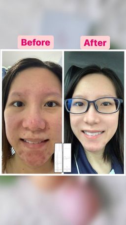 Ellure Tomato Rice Water O₂ Bubble Cleanser 