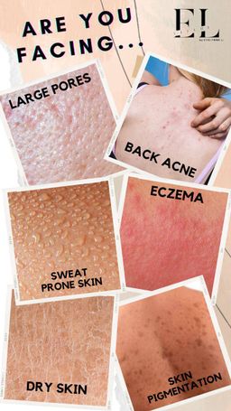 🍅𝐈𝐍𝐒𝐓𝐎𝐂𝐊🍅 𝐄𝐋𝐋𝐔𝐑𝐄 𝐓𝐎𝐌𝐀𝐓𝐎 𝐈𝐍𝐕𝐈𝐆𝐎𝐑𝐀𝐓𝐈𝐍𝐆 𝐒𝐇𝐎𝐖𝐄𝐑 𝐆𝐄𝐋| Skin Problems | Eczema | Back Acne | Sweat Prone Skin | Dry Skin