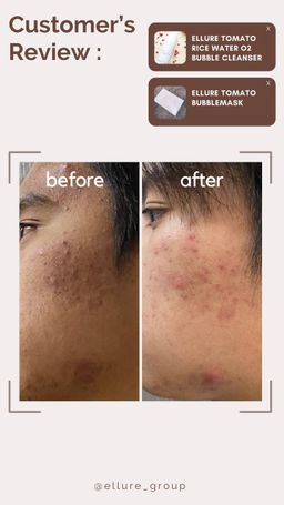 🔥𝐇𝐈𝐆𝐇𝐋𝐘 𝐑𝐀𝐕𝐄𝐃!!🔥 🍅𝐄𝐋𝐋𝐔𝐑𝐄 𝐓𝐎𝐌𝐀𝐓𝐎 𝐃𝐄𝐄𝐏 𝐂𝐋𝐄𝐀𝐍𝐒𝐈𝐍𝐆 𝐆𝐑𝐀𝐏𝐇𝐄𝐍𝐄 𝐁𝐔𝐁𝐁𝐋𝐄 𝐌𝐀𝐒𝐊🍅 - EXFOLIATING MASK