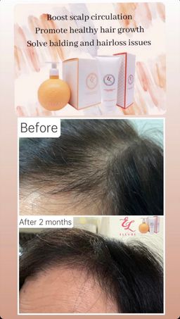 🍅ELLURE LUXURIANT TOMATO HAIR CONDITIONER / SHAMPOO🍅