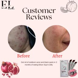 🇰🇷𝐌𝐀𝐃𝐄 𝐈𝐍 𝐊𝐎𝐑𝐄𝐀!🇰🇷 𝐄𝐋𝐋𝐔𝐑𝐄 𝟭𝟬-𝗜𝗡-𝟭 𝗥𝗘𝗗 𝗚𝗜𝗡𝗦𝗘𝗡𝗚 𝗦𝗞𝗜𝗡 𝗕𝗢𝗢𝗦𝗧𝗘𝗥 𝗝𝗘𝗟𝗟𝗬 | 𝐒𝐔𝐏-𝐈𝐓 𝐅𝐑𝐎𝐌 𝐊𝐎𝐑𝐄𝐀! SKIN SUPPLEMENT