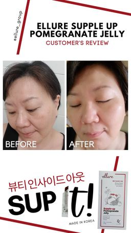 🇰🇷𝐌𝐀𝐃𝐄 𝐈𝐍 𝐊𝐎𝐑𝐄𝐀!🇰🇷 𝐄𝐋𝐋𝐔𝐑𝐄 𝟭𝟬-𝗜𝗡-𝟭 𝗥𝗘𝗗 𝗚𝗜𝗡𝗦𝗘𝗡𝗚 𝗦𝗞𝗜𝗡 𝗕𝗢𝗢𝗦𝗧𝗘𝗥 𝗝𝗘𝗟𝗟𝗬 | 𝐒𝐔𝐏-𝐈𝐓 𝐅𝐑𝐎𝐌 𝐊𝐎𝐑𝐄𝐀! SKIN SUPPLEMENT