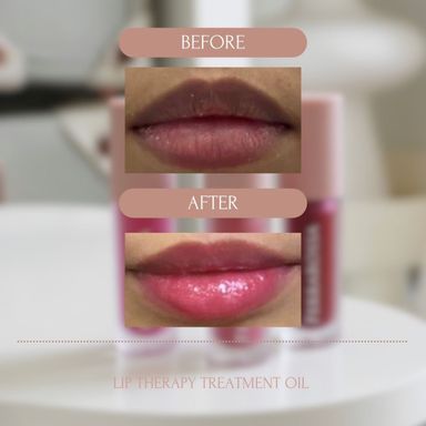 Ferrarossa Lip Therapy Treatment Oil 