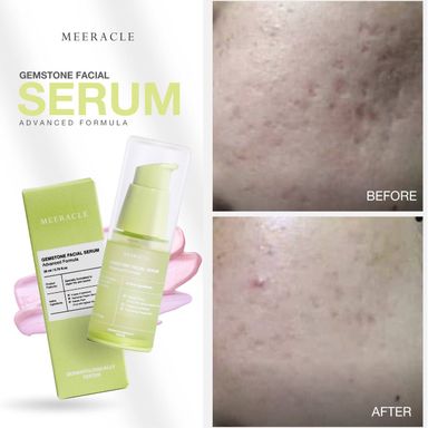 Meeracle Serum