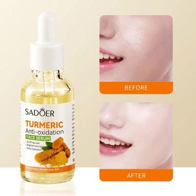 SADOER Turmeric Face Serum , Deep Hydration, Tumeric Serum, Brightening, and Lighten Acne Marks