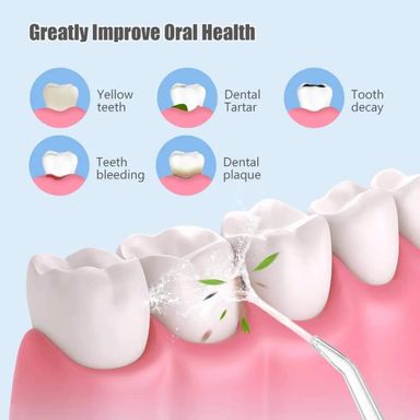 Oral irrigator Convenient electric tooth flushing 