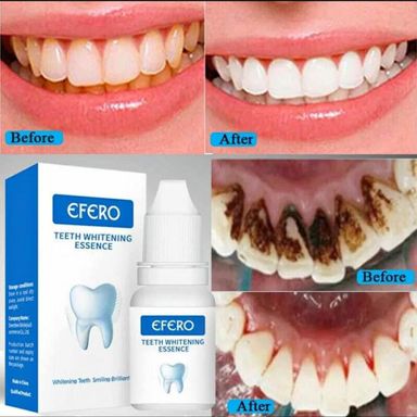 Teeth Whitening Liquid  