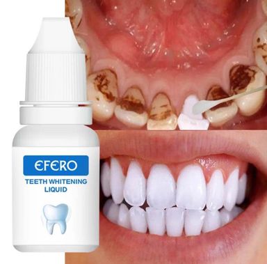 Teeth Whitening Liquid  