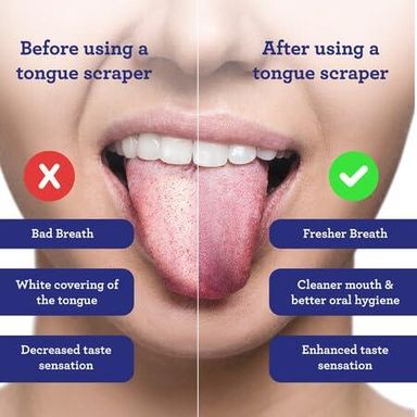 SPOON SHAPED STAINLESS STEEL TONGUE SCRAPER (2-PACK)