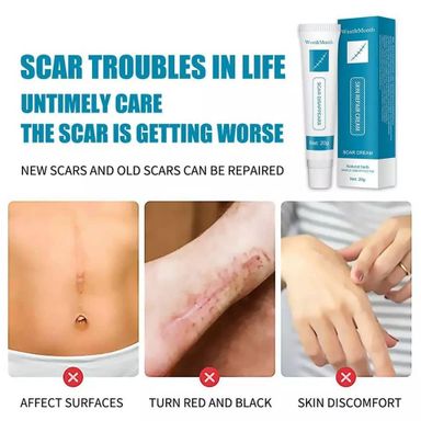 Stretch Marks/Scar Remover