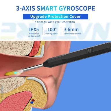 Wifi Otoscope Camera Ear Wax Remover