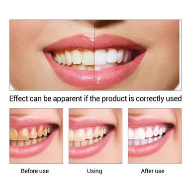 LXRMIMI Teeth Whitening liquid professional easy white teeth whitening essence