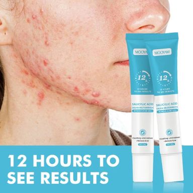 Mooyam Acne treatment gel