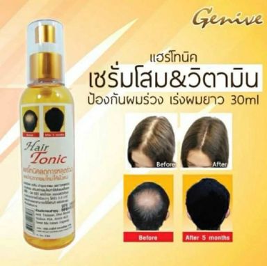 GENIVE  Hair  Tonic Anti loose