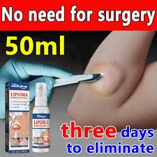 Lipoma removal spray