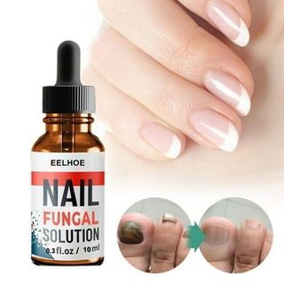 Nail fungal solution