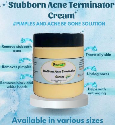 Stubborn Acne Terminator Cream 