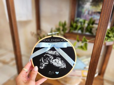 Classic Ultrasound Embroidery Hoop