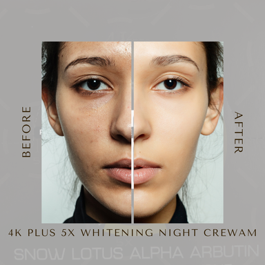 4k Plus 5X Whitening Night Cream- 4k plus cosmetics nepal