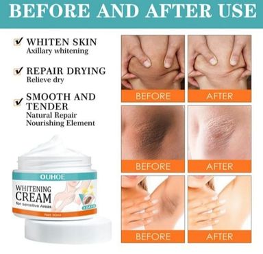 whitening cream for Private part and sensitive areas underarm 7 days result cream.