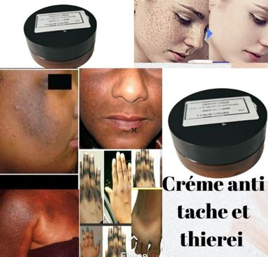 Créme miracle Miyodi anti-impérfections 