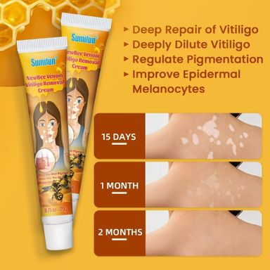 New Bee Venom Vitiligo Removal Cream