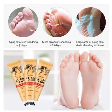  Anti-Crack Foot Cream
