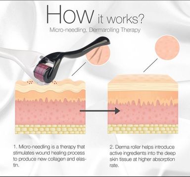 DERMA ROLLER PRO