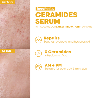 Face Facts Barrier Repair Ceramide Facial Serum