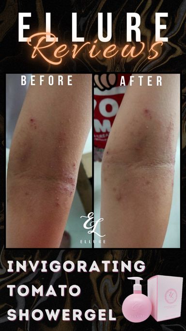 🍅𝐈𝐍𝐒𝐓𝐎𝐂𝐊🍅 𝐄𝐋𝐋𝐔𝐑𝐄 𝐓𝐎𝐌𝐀𝐓𝐎 𝐈𝐍𝐕𝐈𝐆𝐎𝐑𝐀𝐓𝐈𝐍𝐆 𝐒𝐇𝐎𝐖𝐄𝐑 𝐆𝐄𝐋| Skin Problems | Eczema | Back Acne | Sweat Prone Skin | Dry Skin