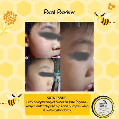Queen Royal Repair and Renew Bee Balm