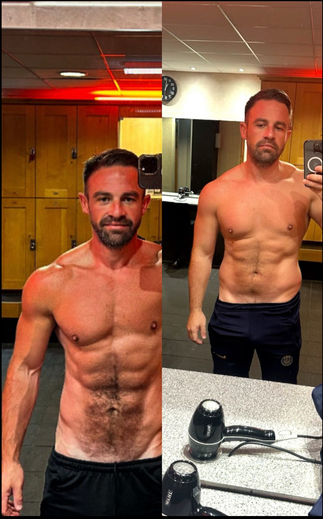 🔬 4 Months of Research Using Retatrutide  📅 Month 1: Started with 10mg total 💉 (4 doses of 2.5mg) ⬆️ Months 2–4: Increased to 20mg/month 📈 Maintained this dosage throughout 💥 Result: An amazing transformation overall ✨💪_0