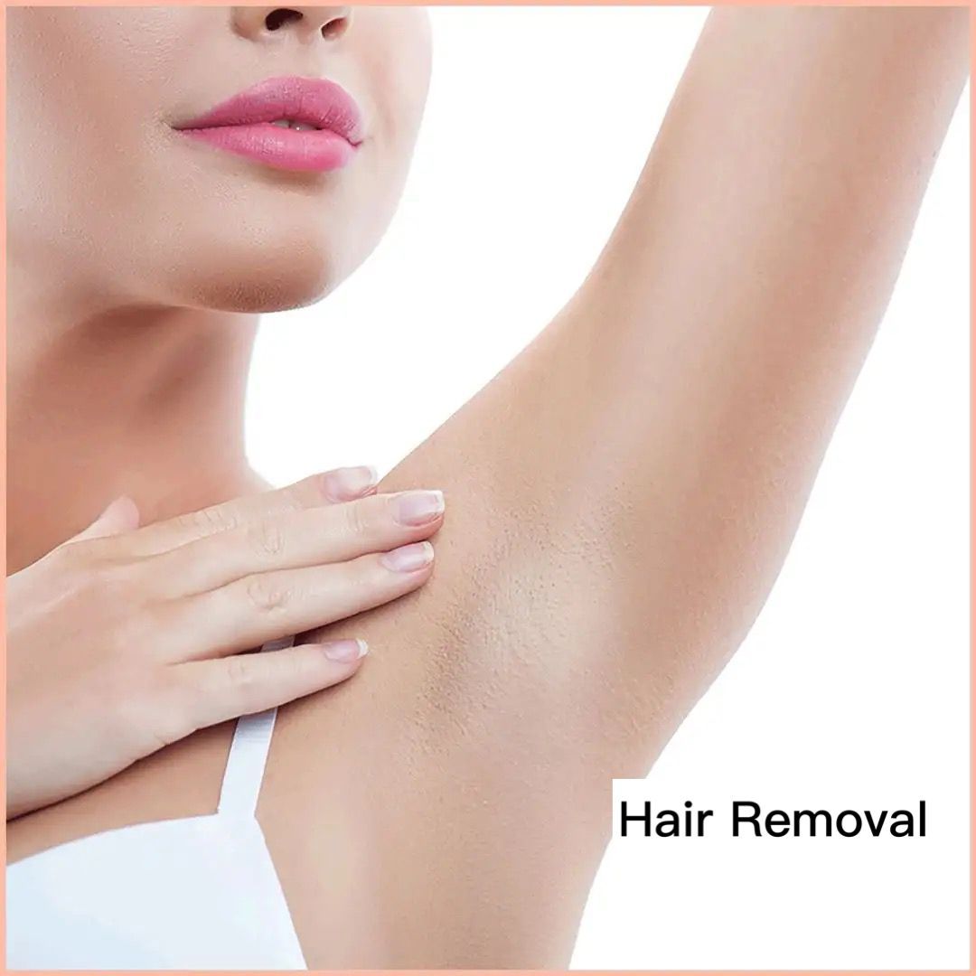 OPT Lip/Underarm Hair Removal (2 sessions promo)